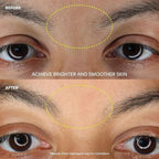 The Leaf Dermaplaner Kit, Fig - Plastic-Free Facial Razor and Exfoliating Tool Set; Includes 1x Dermaplaner, 1x Stand, 10x Refills