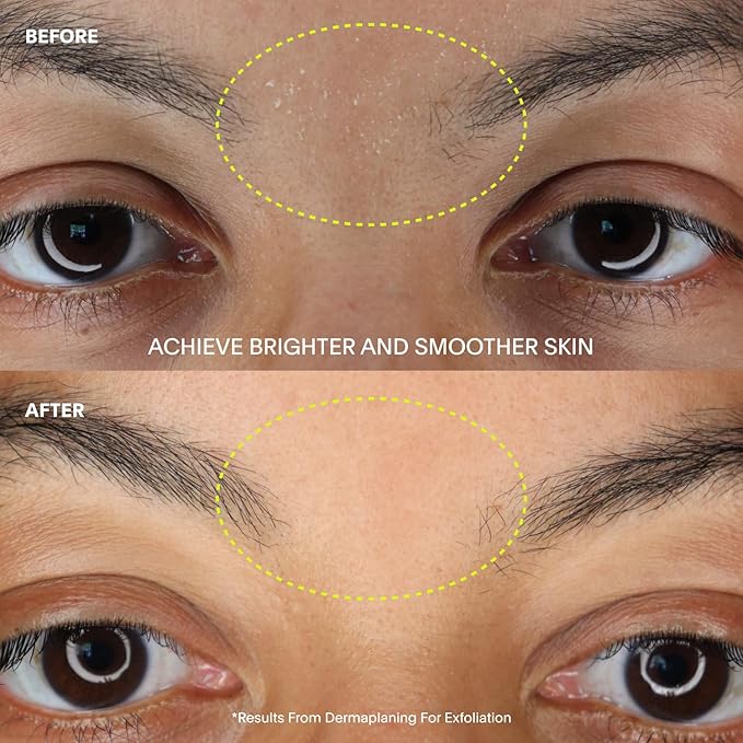 The Leaf Dermaplaner Kit, Fig - Plastic-Free Facial Razor and Exfoliating Tool Set; Includes 1x Dermaplaner, 1x Stand, 10x Refills