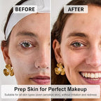 Face Razors for Women, Dermaplane Razor for Women Face, Eyebrow Razor, Facial Razors, Dermaplaning Tool, Gentle Skin Exfoliation Microblades for Sensitive Skin, Peach Fuzz Remover, 10 Count (Lilac)