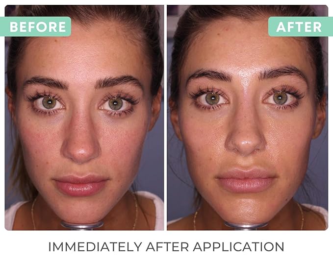 Reflect SPF 42 Tinted Mineral Sunscreen Lotion, Zinc Oxide & Titanium Dioxide, Hyaluronic Acid & Vitamin E, Acne Sunblock, Medical Grade Anti-Aging Face Moisturizer with SPF 2.1 OZ