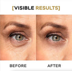 Moisturizing Eye Cream w/Aloe Vera, Collagen, Hyaluronic Acid, Cotton Stem Cells for Dark Circles, Puffiness & Bags - Under Eye Hydration Cream for Women & Men (1 Fl Oz)