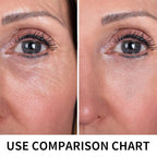 Pdo Threads Lift for Eyes, Pdo Lifting Thread, Improves Wrinkles And Sagging Around The Eye Area (20PCS-30G*25MM)