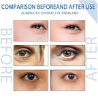 Peptide Depuffing Eye Serum, Himeye Peptide Eye Serum, Men's Caffeine Eye Serum, Men's Collagen Anti-Aging Eye Cream for Wrinkles, 0.5 Ounce (Pack of 2)