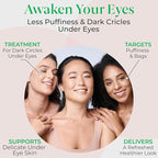 EyeGLO Caffeine Eye Cream for Dark Circles, Eye Bags, and Puffiness | Under Eye Treatment for Women with Peptides, Antioxidants, Hyaluronic Acid | Natural Brightening Eye Cream - 1 Oz