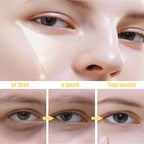 Under Eye Patches for Eye Patches for Puffy Eyes and Dark Circles