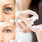 Eye Cream for Dark Circles and Puffiness - Rapid Reduction Under Eye Care Collagen Treatment Serum 1.7 oz