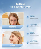 Hyaluronic Acid Self Heating Warm Compress for Eyes, Heated Eye Mask for Fast Relief of Dry Eyes, 7 Pack Steam Eye Mask, Moisturizing & Highly Effective Steam Eye Mask