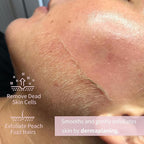 Dermaplane Razor, Face Razors for Women, Dermaplaning Tool for Women Face, Remove Facial Hair and Perfectly Shape Brows, with Protective Cover, 5 Count, Pink