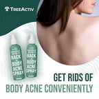 Salicylic Acid Back & Body Acne Spray, Back Acne Solution For Women And Men, Acne Body Spray with Tea Tree Oil, Fast-Drying Back Acne Spray, Fine Mist, Back Acne Treatment Spray, 4 fl oz, 2-pack