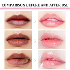 2pcs Lip Lightening for Dark Lips Lip Brightener for Smokers Dark Lip Treatment Lightening Cream for Pink Lips Lip Lightener for Smoker Lips Lip Lightening balm for Men and Women (Orange)