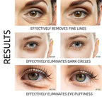 Under Eye Patches - 30 Pairs Collagen Eye Mask Eye Patches for Puffy Eyes and Dark Circles, Gel Under Eye Mask, Black