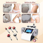 Body Machine Body Multifunctional Beauty Machine Cellulite Device, White