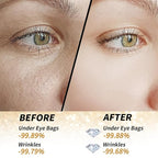 Golden Glow Under Eye Patches for Puffy Eyes - 60Pcs Eye Gels Rejuvenating Treatment for Dark Circles, Puffiness, Refreshing,Revitalizing Looks Less Tired