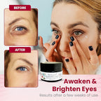 Wild Rose Renewal Eye Cream, Under Eye Cream, Natural Eye Cream for dark circles and fine lines, Green Beauty Product for under Eye area, Natural Skin Care .55 FL OZ (16.26ml)