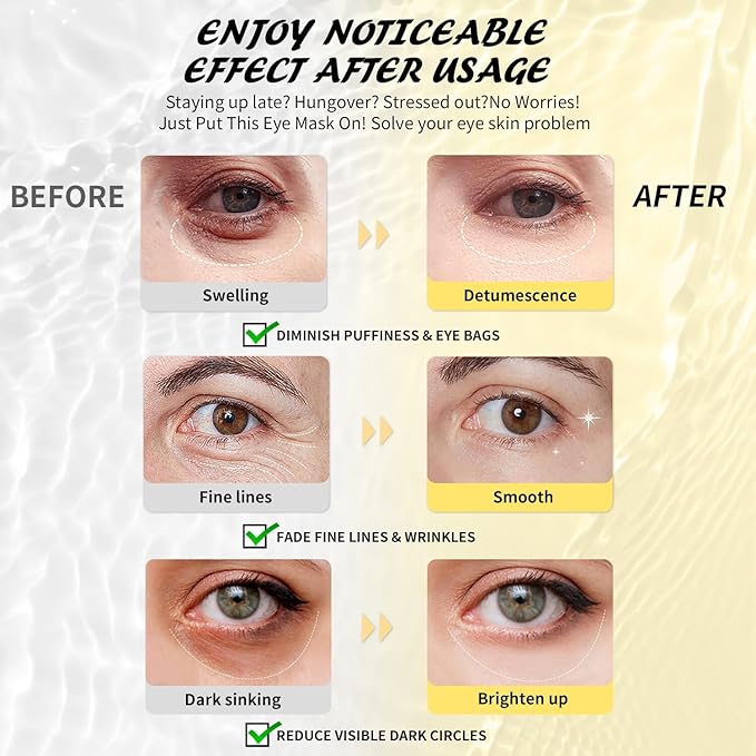 Under Eye Patches (8 Pairs), Hyaluronic Acid Eye Masks for Dark Circles Puffy Eyes Undereye Bags, Collagen Eye Patches for Wrinkles and Hydrate, Skin Care Gift for Her