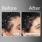 Act+Acre 3-Pack Mini Cold Processed Stem Cell Scalp Serum - Promotes Thicker, Fuller-Looking Hair - Soothes and Hydrates - Sulphate and Paraben Free - Aloe Vera for Improved Scalp Health