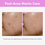 9 Peptide Skin Booster Serum, Niacinamide & Hyaluronic Acid Skin Renewal Boosting Facial Essence for All Skin Types, Korean Skin Care, Paraben Free, 150ml, 5.07 fl.oz.