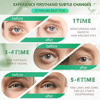 60 pcs green under eye