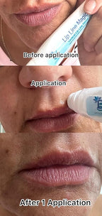 Lip Line Serum For Lines Above the Lips, Strength,