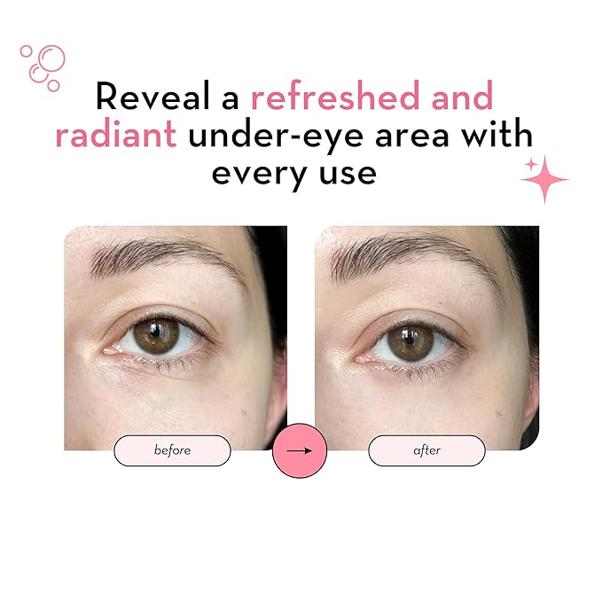 Elizabeth mott under eye patches