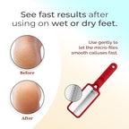 Microplane Colossal Foot File Scraper - The Original Stainless Steel Foot Rasp, Dead Skin/Callus Remover for Feet, Gentle Foot Scrubber, Pedicure Tools for Salon-Quality Foot Care, Red