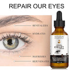 Dark Circles Under Eye Treatment for Women Caffeine Serum Circles, Puffiness, Bags, Anti Aging Reduces Wrinkles and Fine Line, 100% Pure Coffee Oil - 1 oz / 30 ml, 1 Fl Oz (Pack of 1)