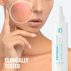 BRIOTECH Renew Toner, Hypochlorous Acid Spray, Minimize Appearance of Blemishes, Soothing Facial Mist for Sensitive Skin, Calm Redness & Bumps, Hypoallergenic & Vegan, 2 fl oz Travel Size (2)