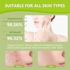 30pads turmeric kojic acid cleansing