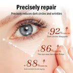 Retinol Eye Cream Anti Aging + 24k Under Eye Patches Kit, Under Eye Patches For Puffy Eyes And Dark Circles, Under Eye Cream With Retinol Serum,Dark Circle Eye Cream For Moisturizing, Firming