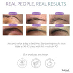 LiBrow® Purified Eyebrow Physician-Formulated Serum XL for Fuller & Thicker Looking Eyebrows | Natural Eyebrow Enhancer Safe for Sensitive Skin | 6-Month Supply (6ml)