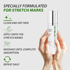 Abera Ovela Maternity Stretch Mark Cream with Eye Mask for Pregnancy and Weight Fluctuations, Stretch Mark Treatment Pregnancy Must Haves, Deep Stretch Mark Removal, All Skin Types, 1.69 fl oz