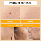 Bee venom cream for removing