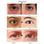 Under Eye Patches For Dark Circles, Aloe Vera Eye Mask For Puffiness, Hydrating Eye Gel Pads For Eye Bags And Wrinkles Under Eye Treatment, Improve And Firm Eye Skin Reduce Fine Lines - 30 Pairs