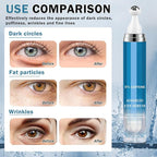 Caffeine Under Eye Cream for Dark Circles Eye Cream for Puffiness and Bags Under Eyes,Eye Roller for Puffy Eyes and Firming,Wrinkle Reducing Crema Para las Ojeras