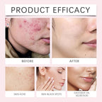 40pc turmeric kojic acid cleansing