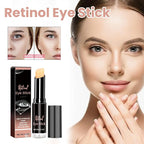 Retinol Eye Stick, Retinol Eye Cream for Dark Circles and Puffiness, Under Eye Cream Anti Aging, Retinol Eye Balm Reduce Fine Lines and Dark Circles, Visible Results in 3-4 Weeks