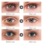 30 PCS Under Eye Collagen Patches,Crystal Pink Collagen Lip Masks，Gold Moisturizing Under Eye Mask，moisturizing skin, anti-chapping and anti-aging.…