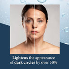 Elite Serum Rx - Anti Aging Under Eye Serum for Dark Circles and Puffiness with 8 Patented Peptides - Extra Strength Lifting and Firming Treatment for Wrinkle Repair and Eye Bag Removal