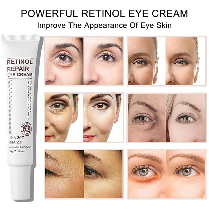 Retinol Eye Cream Anti Aging + 24k Under Eye Patches Kit, Under Eye Patches For Puffy Eyes And Dark Circles, Under Eye Cream With Retinol Serum,Dark Circle Eye Cream For Moisturizing, Firming