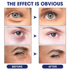 Anti Wrinkle Essence, Glozie Eye Serum, Glozie Instant Eye Lift Eye Cream, Anti Wrinkle Serum, Eye Cream For Wrinkles, Instant Anti-Aging Firm Eye Temporary Eye Tightener, Permanent Anti-Aging Cream