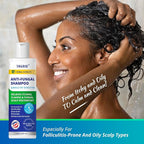TAGRID Anti-Fungal Shampoo 300mL – Scalp Treatment for Psoriasis, Seborrheic Dermatitis, Folliculitis, Dandruff & Itchy Flaky Scalp – Soothing Plant-Based Formula for Men & Women