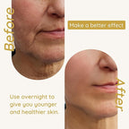 Enaskin Naturals Anti Wrinkle Face Patches Anti Wrinkle Gel Face Masks (1 Pack)