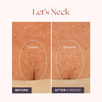 Womaness Let's Neck Firming Serum - Hydrates, Lifts, and Smoothes with Cooling & Massaging Roller Applicator - Cream for Women to Smooth Wrinkles & Tightening Sagging Skin - 50ml Roller