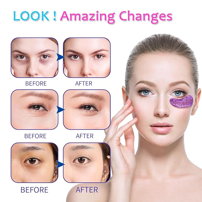 [ 28 Pairs ] Under Eye Patches, Eye Gel Mask for Puffy Eyes and Dark Circles with Natural Marine Collagen Reduce Wrinkles Anti-Aging Face Eye Skin Care Mask for Face,Puffiness, Eye Bags and Wrinkles