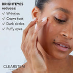 CLEARstem - BRIGHTEYES - Nourishing Anti-Aging Eye Gel - For Puffy Eyes, Crow's Feet, & Dark Circles - Made with Collagen, Stem Cells, Peptides & Aloe Vera - Vegan - Gluten Free - Men & Women - 0.6 oz