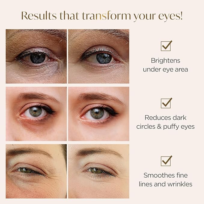 PLANTIFIQUE Gold Under Eye Patches for Puffy Eyes and Dark Circles 5 Pairs Under Eye Masks for Dark Circles and Puffiness Eye Gels with Collagen & Caffeine Eye Patches Gold Eye Mask Skincare