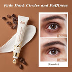 ANAI RUI Caffeine Eye Cream, Niacinamide Eye Cream for Dark Circles and Puffiness, Anti Aging & Friming Eye Cream with Eye Roller, Caffeine Under Eye Cream for Puffy Eyes, Bag Treatment 0.5 FL.OZ