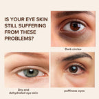 Caffeine Eye Cream for Dark Circles, Under Eye Treatment Eye Cream with Caffeine Anti Aging Wrinkles Lifting Firming Moisturizer Tightening Eye Cream 20ML