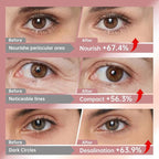 Novoy 15 Pairs Bio-Collagen Real Deep Eye Patches - 6-in-1 Retinol Overnight Eye Patches for Dark Circles, Puffiness & Wrinkles | 2% Caffeine/Hyaluronic/Niacinamide, Korean Popular Eye Mask - Lavender