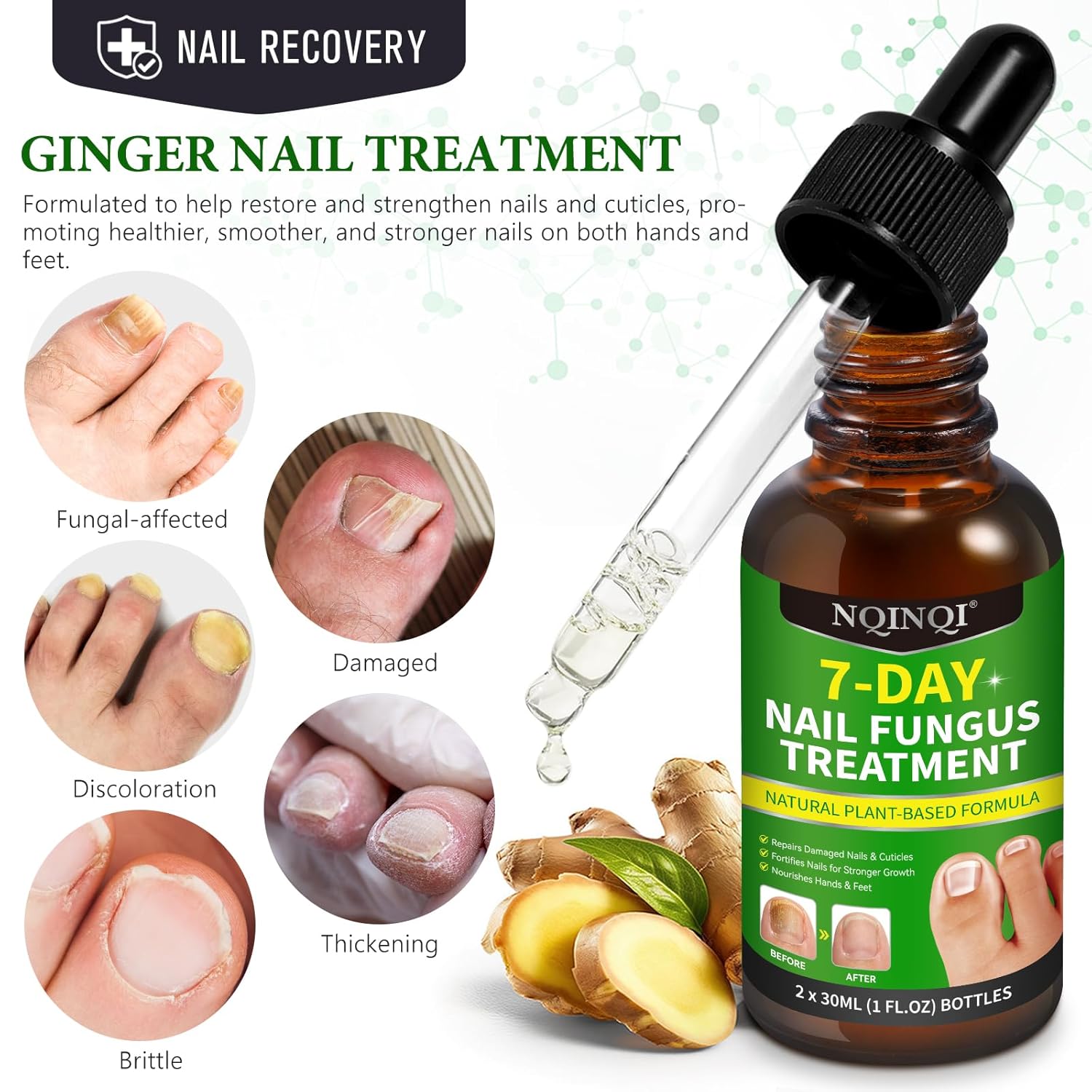 Nail Treatment, 7 Days Nail Treatment Extra Strength, Nail Liquid Maximum Strength - Ginger Nail Treatment Serum for Strengthen & Promote Nail Growth with Natural Plant Formula- 2PCS
